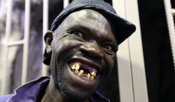 Zimbabwe&#039;s Mr Ugly contest winner &#039;too handsome&#039;