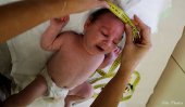 22 births with unusually small heads