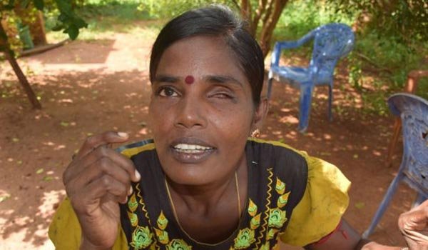 Many war-affected people live with shrapnel in their bodies