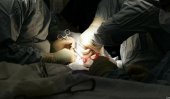 Further revelations in kidney transplant racket