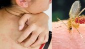Severe skin disease spreading in SL