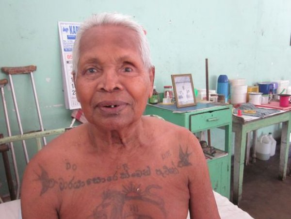 Leprosy victims live out their lives in Sri Lanka colony