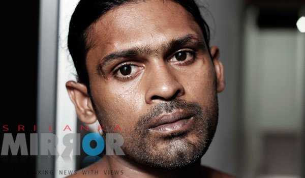 &#039;Kondaya&#039; shows his scars (pics)