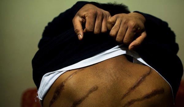 Governments change, but the torturers stay the same