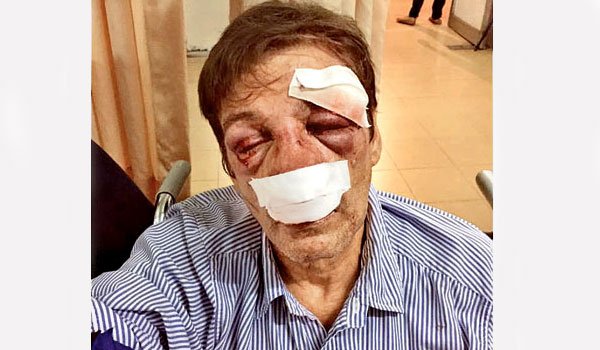 French national severely assaulted in Matara