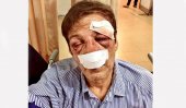 French national severely assaulted in Matara