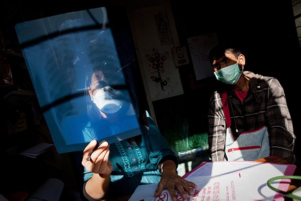 Clinics to find unreported TB patients