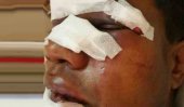 2 surgeries for Dinesh Dodamgoda