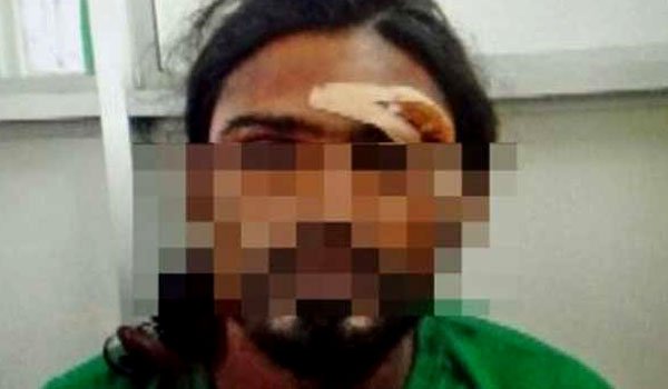 Siblings to bail Kondaya?