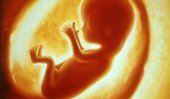 658 illegal abortions a day in Sri Lanka