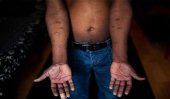 Torture of Tamil detainees in Sri Lanka has continued, says charity